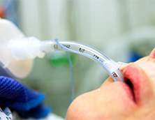 Endotracheal Tube Parts and Function
