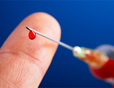 Lancet Needle：Needlestick Injury Management