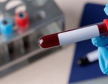 What Is Blood Collection Tube and Why Is It Important?